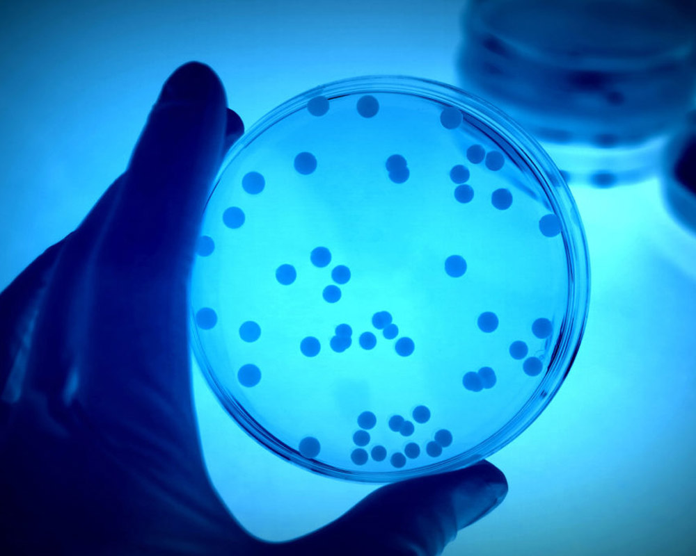 prevencion-de-la-legionelosis